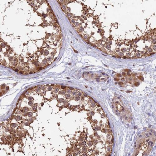 Immunohistochemical staining of human te