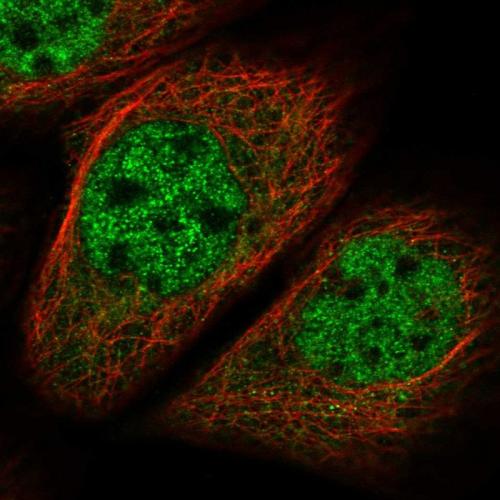 Immunofluorescent staining of human cell