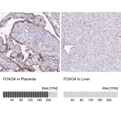 Immunohistochemistry analysis in human p