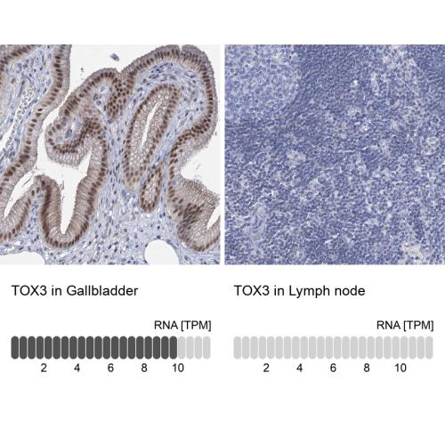 Immunohistochemistry analysis in human g