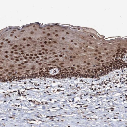 Immunohistochemical staining of human ce