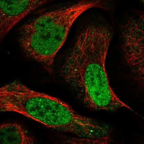 Immunofluorescent staining of human cell