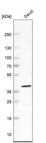 Western blot analysis in human cell line