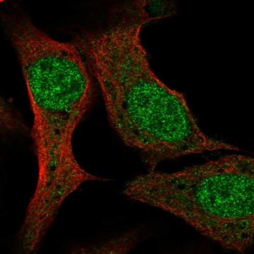 Immunofluorescent staining of human cell