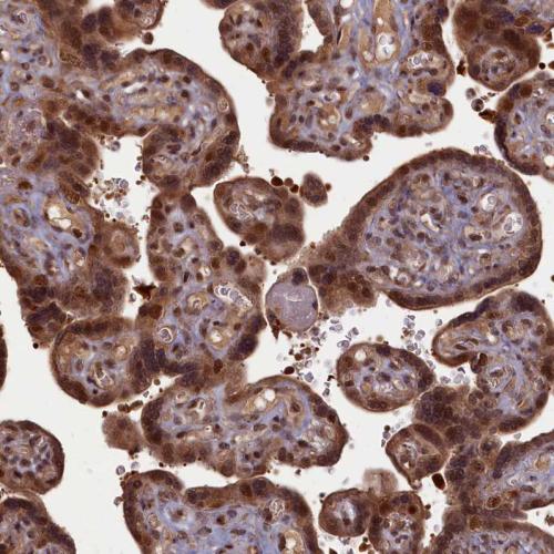Immunohistochemical staining of human pl