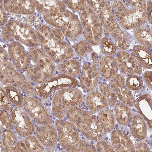Immunohistochemical staining of human ki
