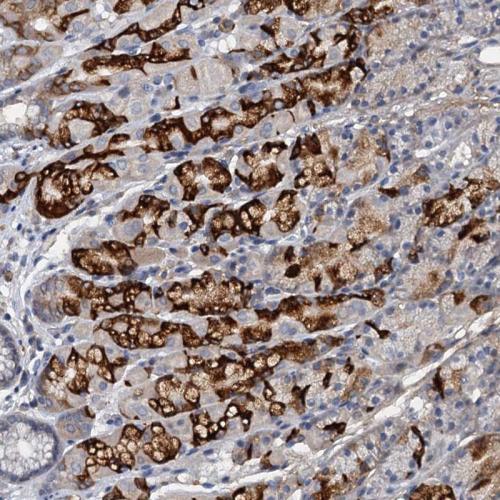 Immunohistochemical staining of human st