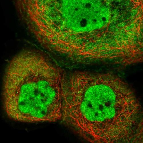 Immunofluorescent staining of human cell