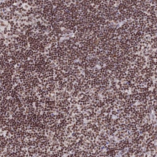 Immunohistochemical staining of human ly