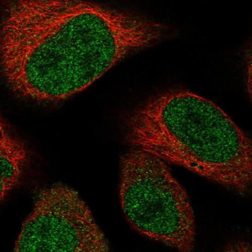 Immunofluorescent staining of human cell