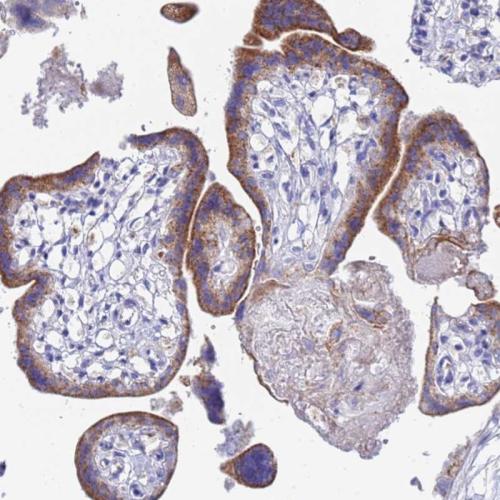 Immunohistochemical staining of human pl