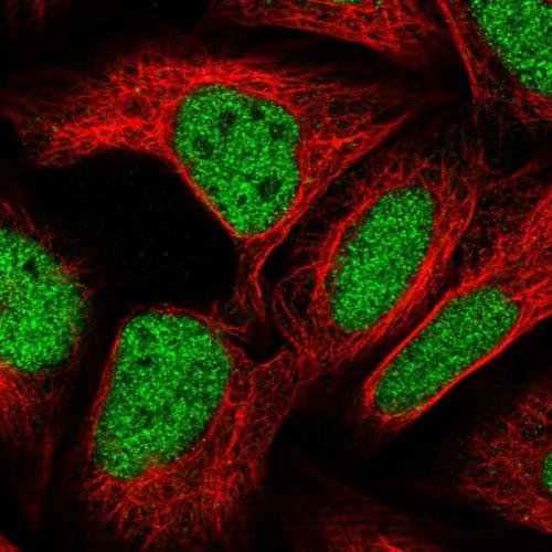 Immunofluorescent staining of human cell