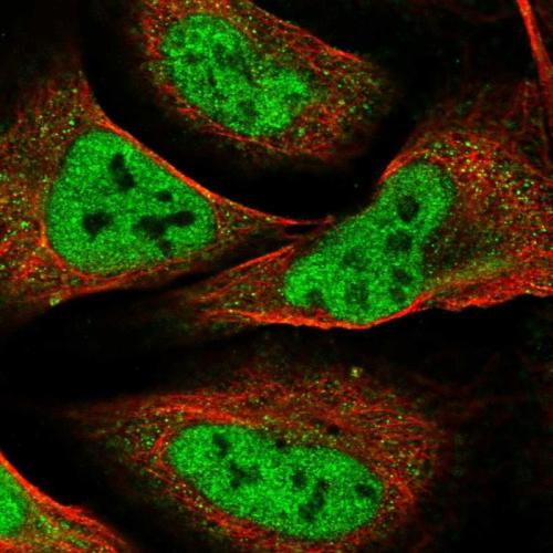 Immunofluorescent staining of human cell