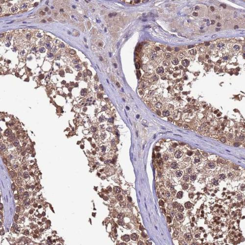 Immunohistochemical staining of human te
