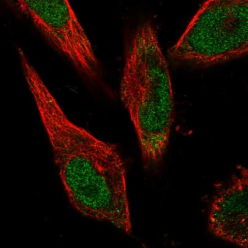 Immunofluorescent staining of human cell
