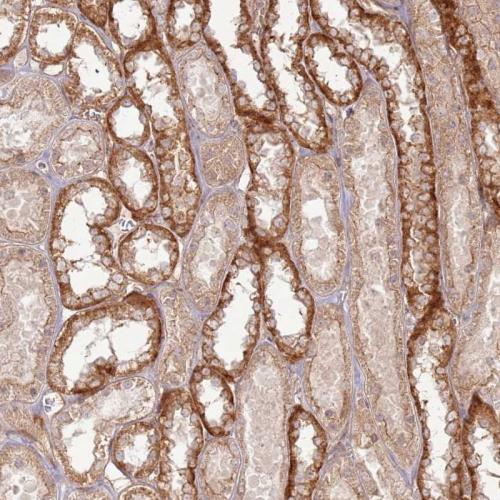 Immunohistochemical staining of human ki