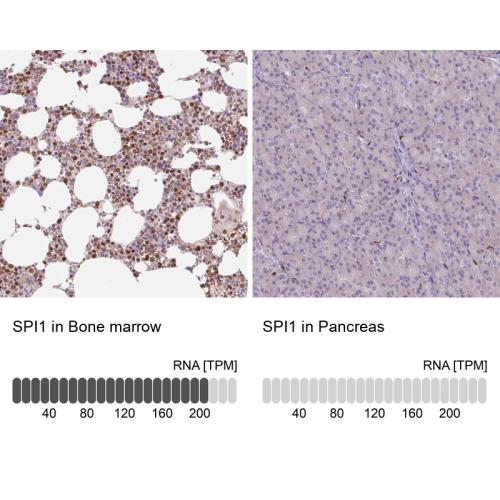 Immunohistochemistry analysis in human b