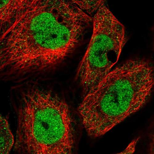Immunofluorescent staining of human cell
