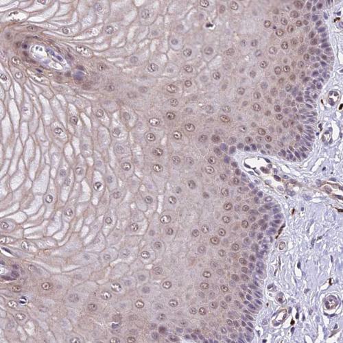 Immunohistochemical staining of human ce