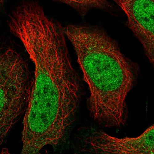 Immunofluorescent staining of human cell