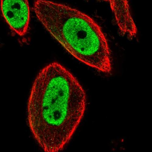 Immunofluorescent staining of human cell