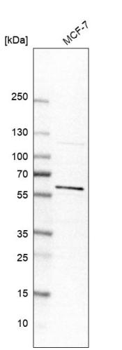 Western blot analysis in human cell line