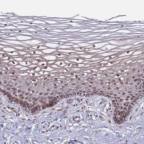 Immunohistochemical staining of human ce