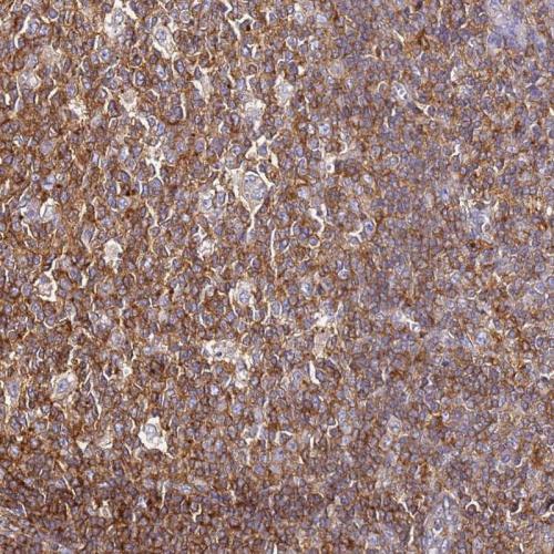 Immunohistochemical staining of human to