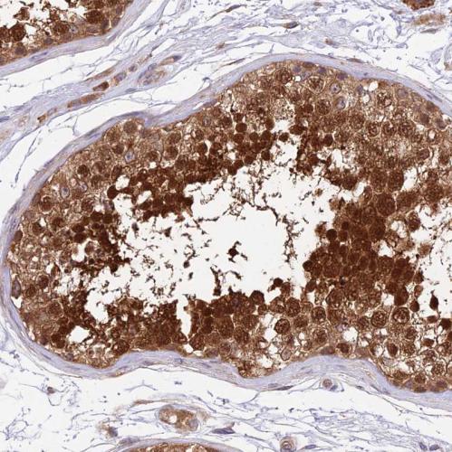 Immunohistochemical staining of human Te