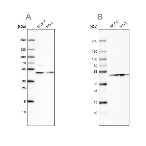 Western blot analysis using Anti-NELFE a