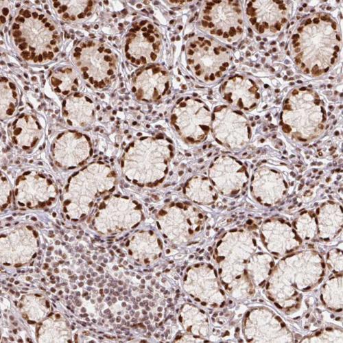 Immunohistochemical staining of human st