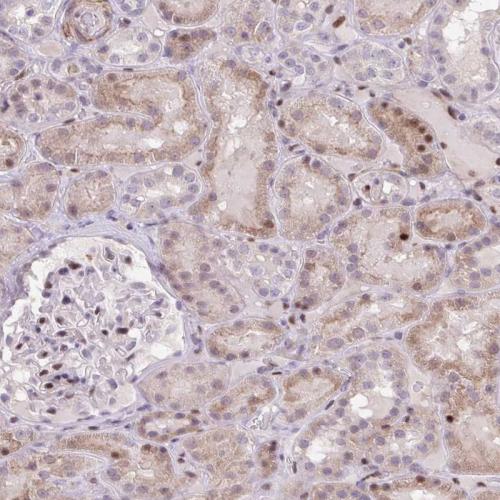 Immunohistochemical staining of human ki