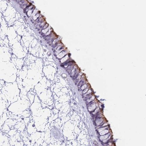 Immunohistochemical staining of human na
