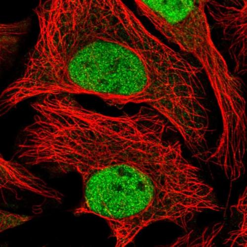 Immunofluorescent staining of human cell