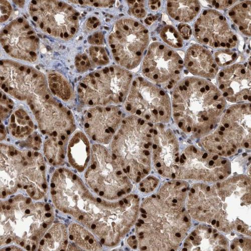 Immunohistochemical staining of human ki