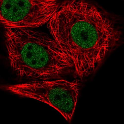 Immunofluorescent staining of human cell