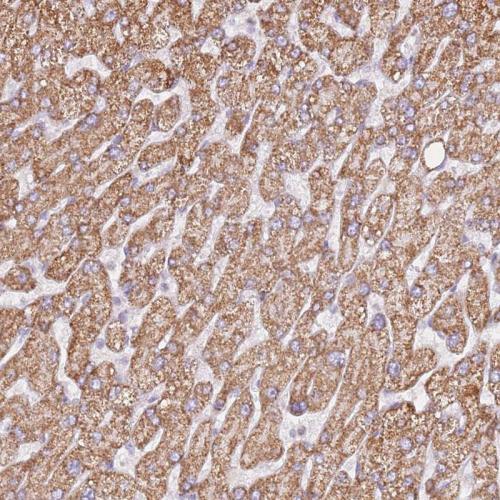 Immunohistochemical staining of human li