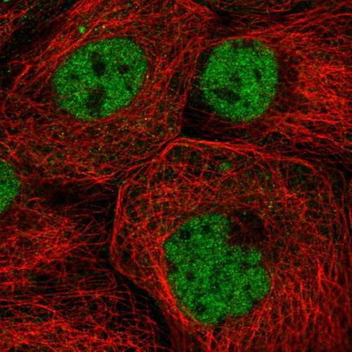 Immunofluorescent staining of human cell