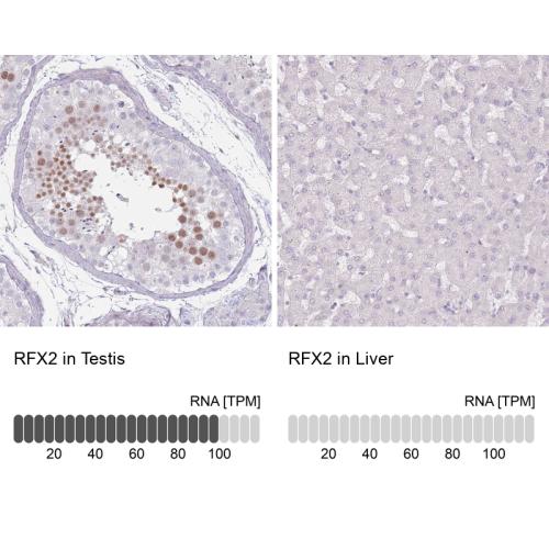 Immunohistochemistry analysis in human t