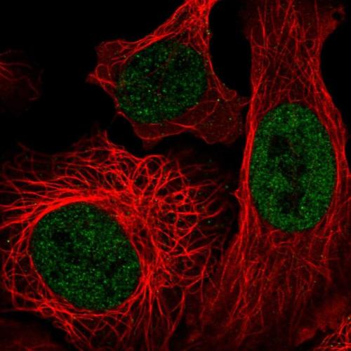 Immunofluorescent staining of human cell