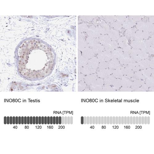 Immunohistochemistry analysis in human t