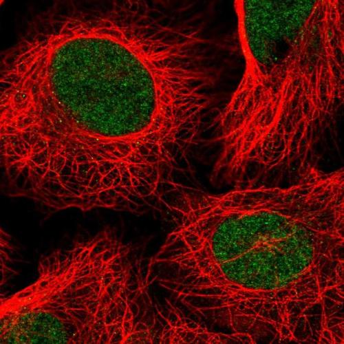 Immunofluorescent staining of human cell