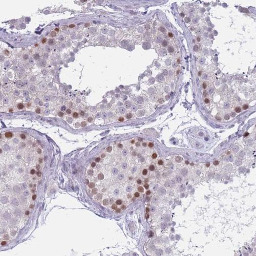 Immunohistochemical staining of human te