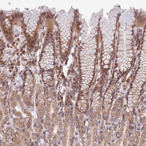 Immunohistochemical staining of human st