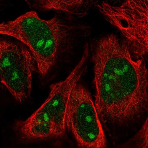 Immunofluorescent staining of human cell
