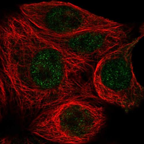 Immunofluorescent staining of human cell