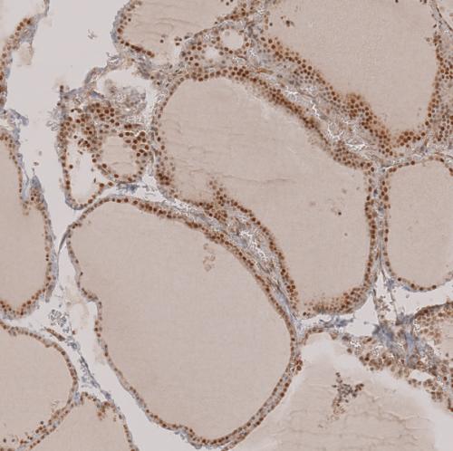 Immunohistochemical staining of human th