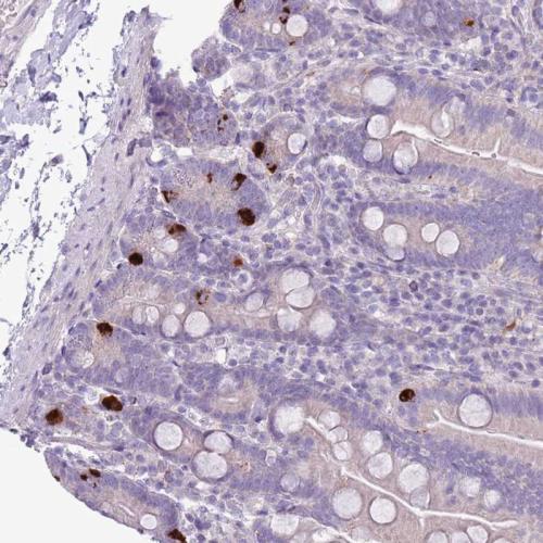 Immunohistochemical staining of human sm