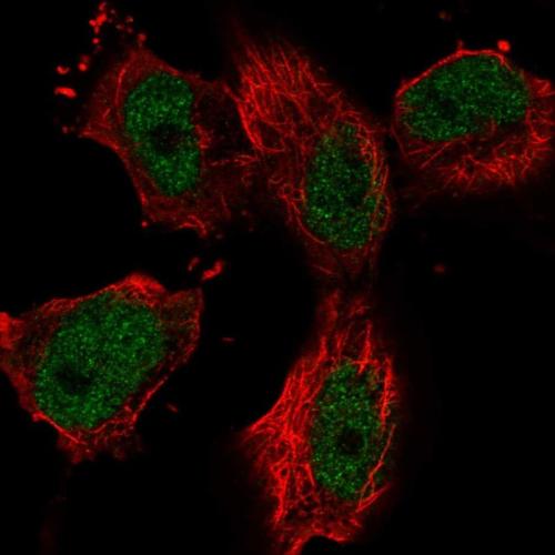 Immunofluorescent staining of human cell