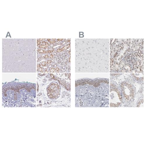 Immunohistochemical staining of human ce